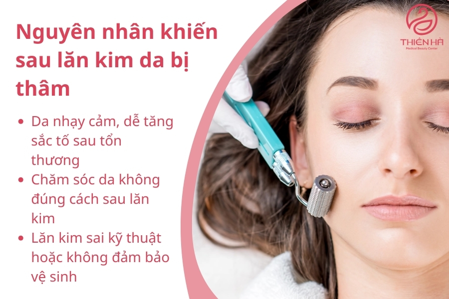 triệt lông sạm da