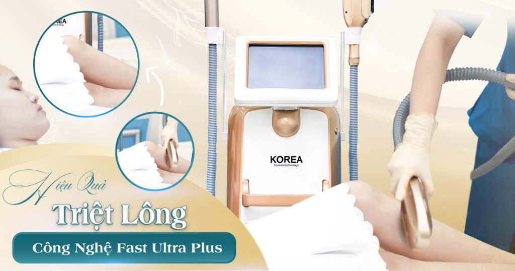 Phụ nữ sau sinh triệt lông