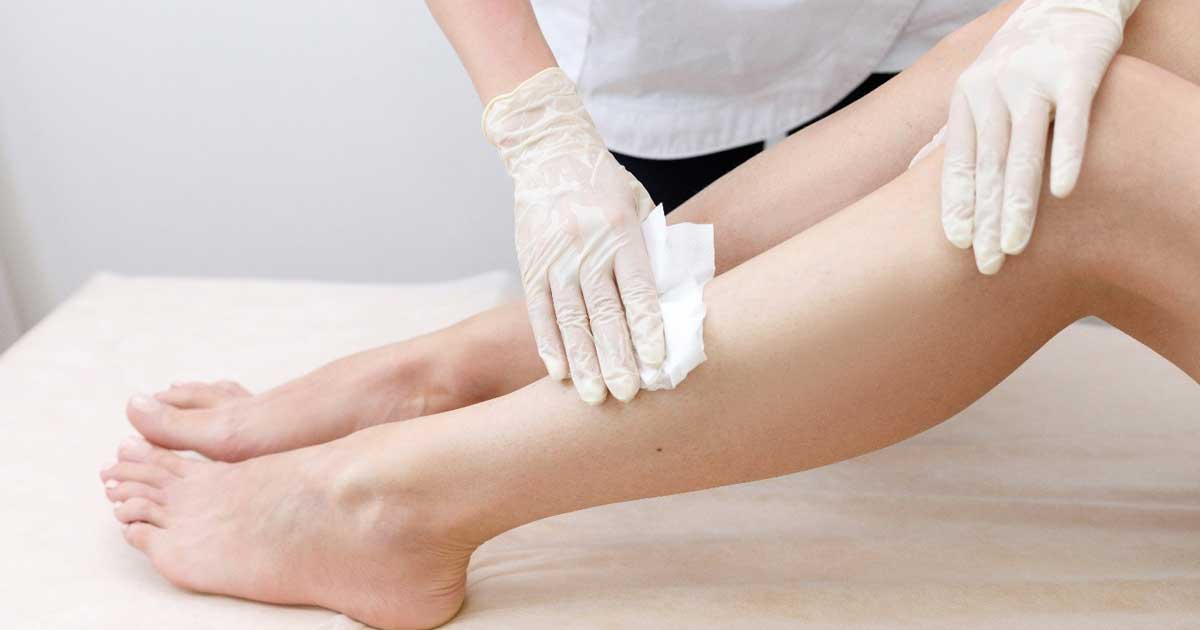 Chuẩn bị triệt lông