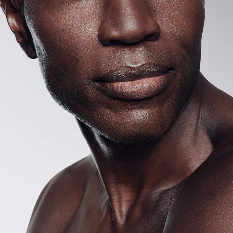 *   da tối màu triệt lông laser