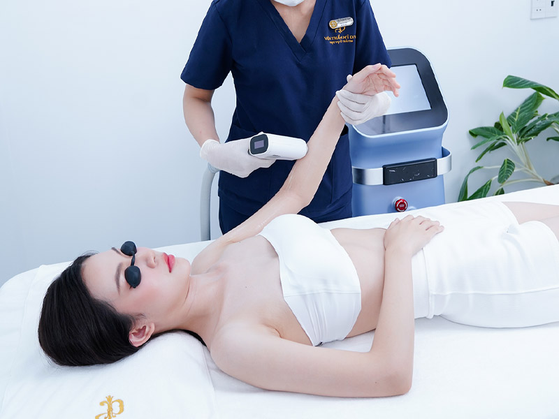 Triệt lông IPL vs laser
