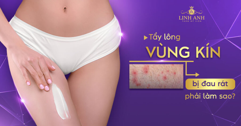 Lông mu đặc điểm