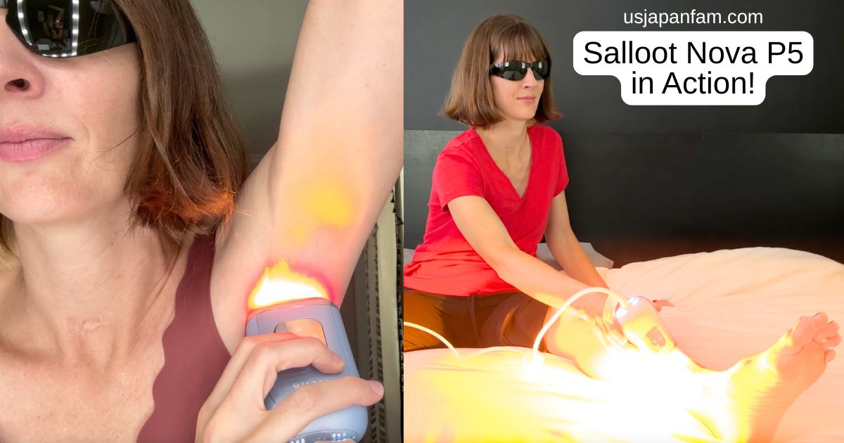 *   Triệt lông bằng ánh sáng vs bằng laser