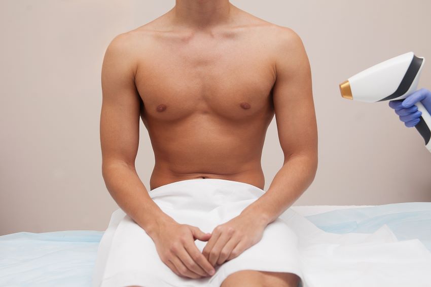 *   vùng da khó triệt lông hình ảnh