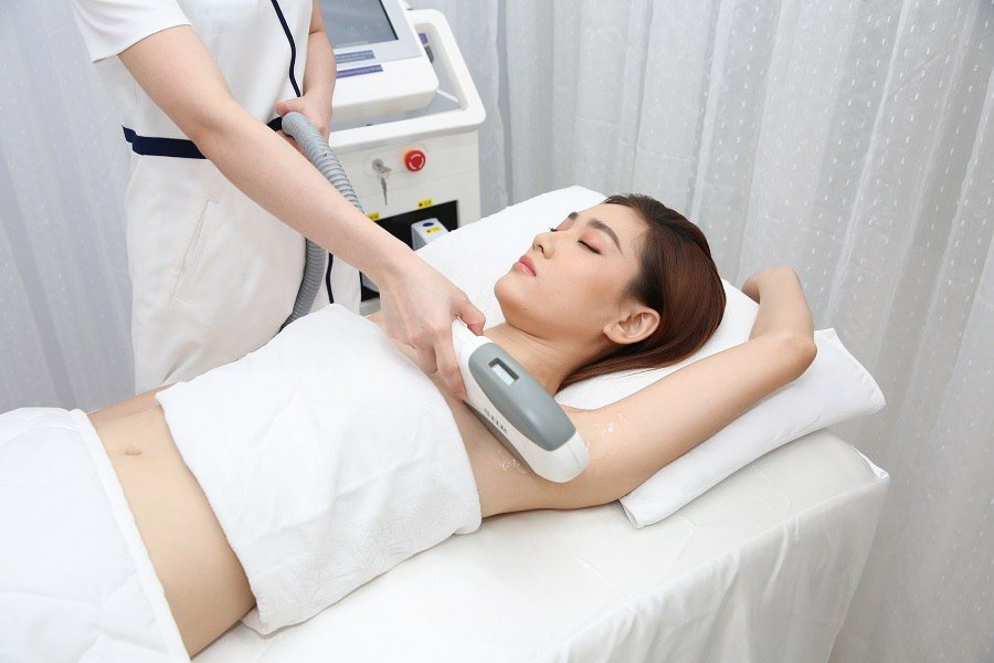 Triệt lông vĩnh viễn