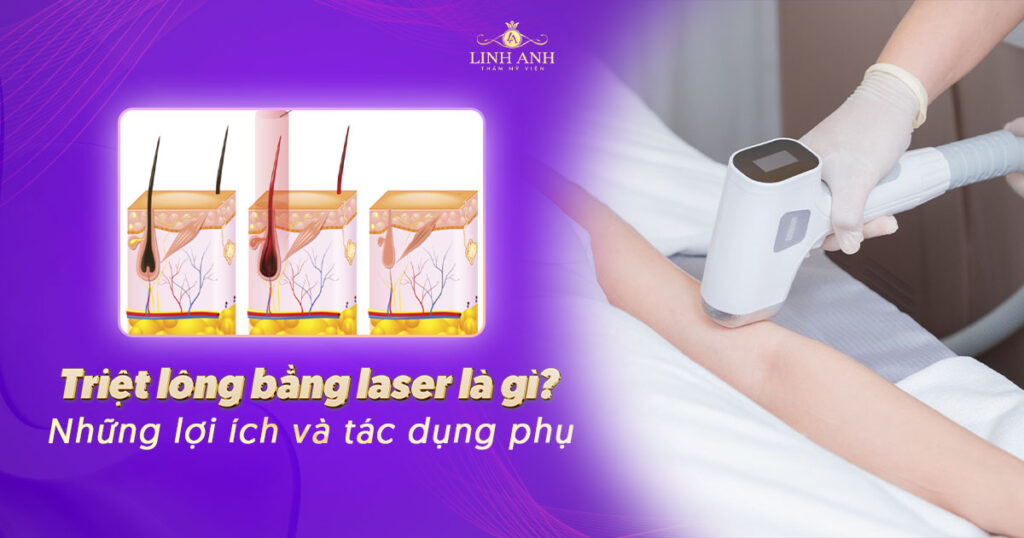 Triệt lông bằng ánh sáng vs laser